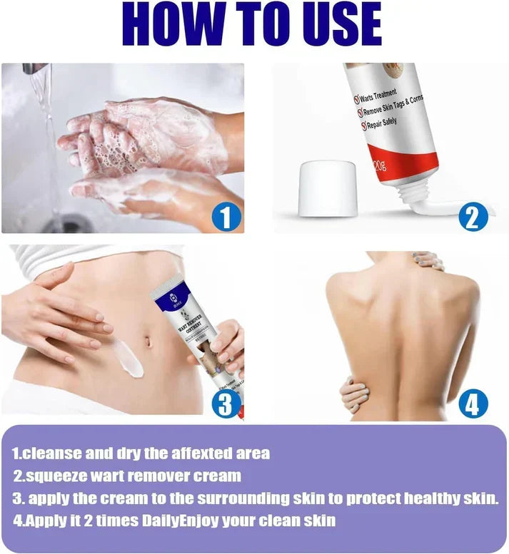 Wart Removal Gel