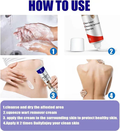 Wart Removal Gel